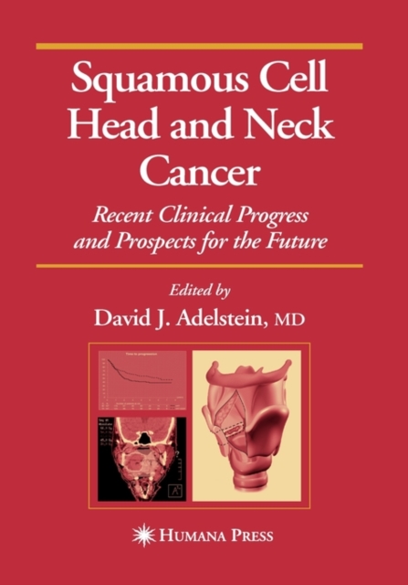 Squamous Cell Head and Neck Cancer : Recent Clinical Progress and Prospects for the Future, Hardback Book