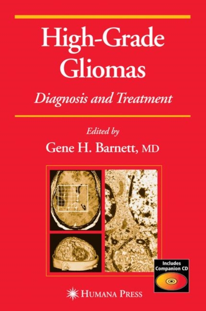 High-Grade Gliomas : Diagnosis and Treatment, Hardback Book