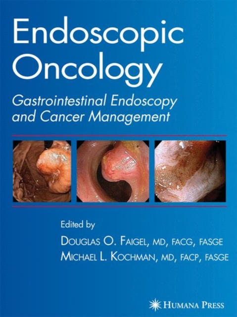 Endoscopic Oncology, Hardback Book