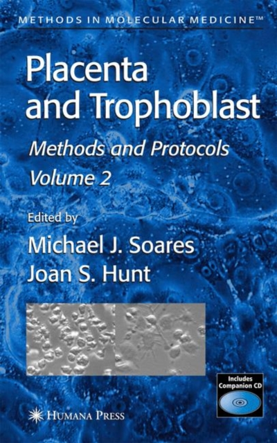 Placenta and Trophoblast : Methods and Protocols, Volume II, Hardback Book