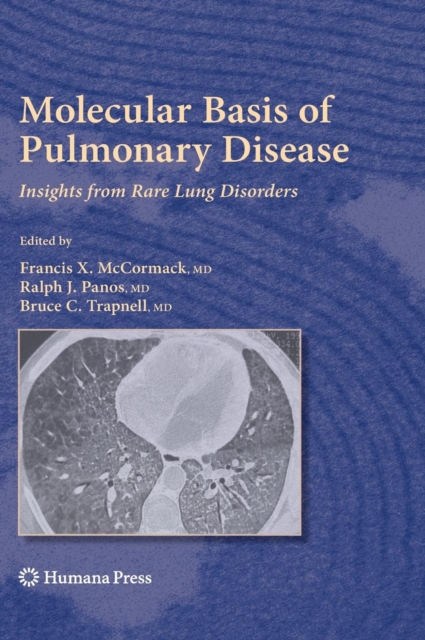 Molecular Basis of Pulmonary Disease : Insights from Rare Lung Disorders, Hardback Book