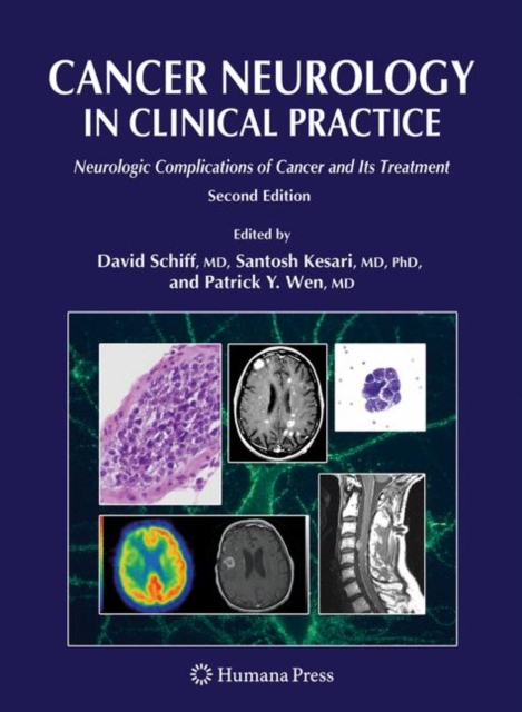 Cancer Neurology in Clinical Practice : Neurologic Complications of Cancer and Its Treatment, Hardback Book