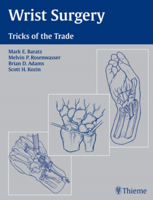 Wrist Surgery : Tricks of the Trade, Hardback Book