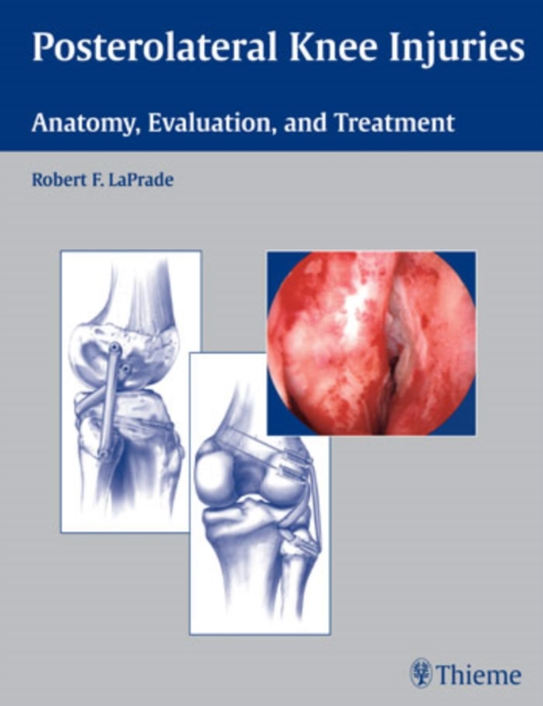 Posterolateral Knee Injuries : Anatomy, Evaluation, and Treatment, Hardback Book