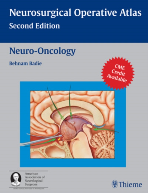 Neuro-Oncology, Hardback Book