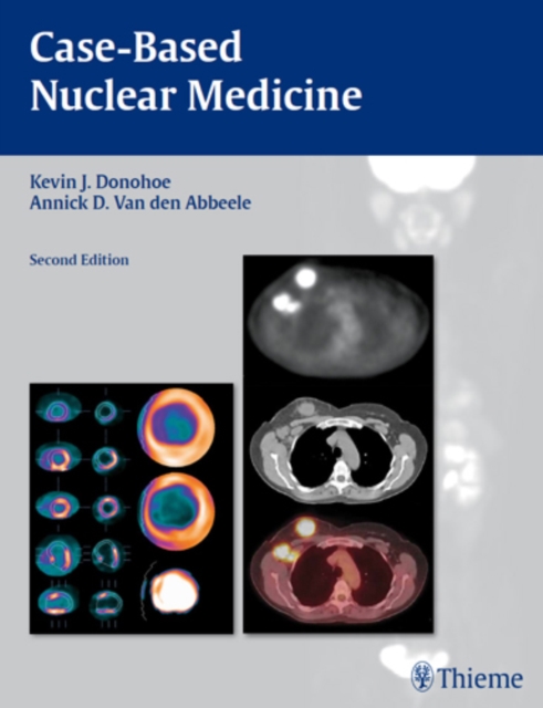 Case-Based Nuclear Medicine, Paperback / softback Book