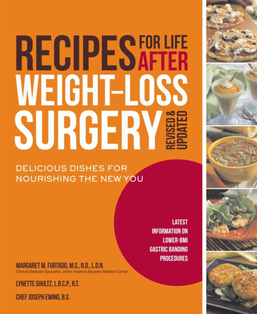 Recipes for Life After Weight-Loss Surgery, Revised and Updated : Delicious Dishes for Nourishing the New You and the Latest Information on Lower-BMI Gastric Banding Procedures, Paperback / softback Book