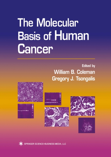 The Molecular Basis of Human Cancer, PDF eBook