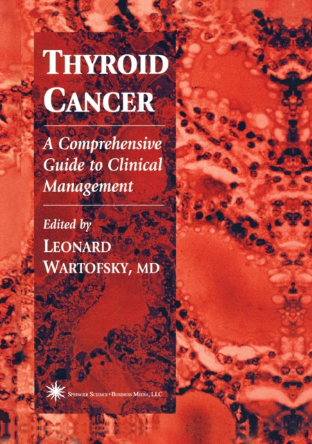Thyroid Cancer : A Comprehensive Guide to Clinical Management, PDF eBook