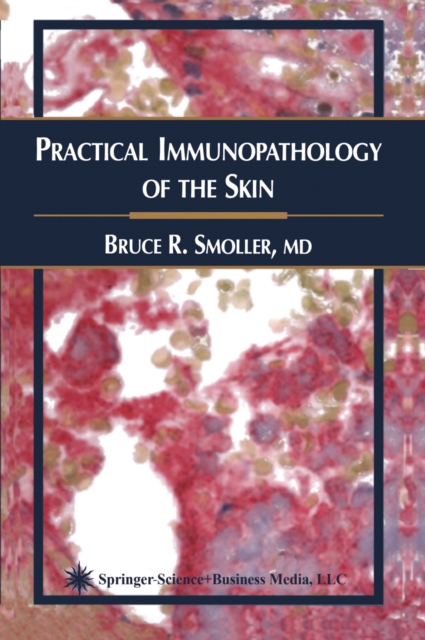 Practical Immunopathology of the Skin, PDF eBook