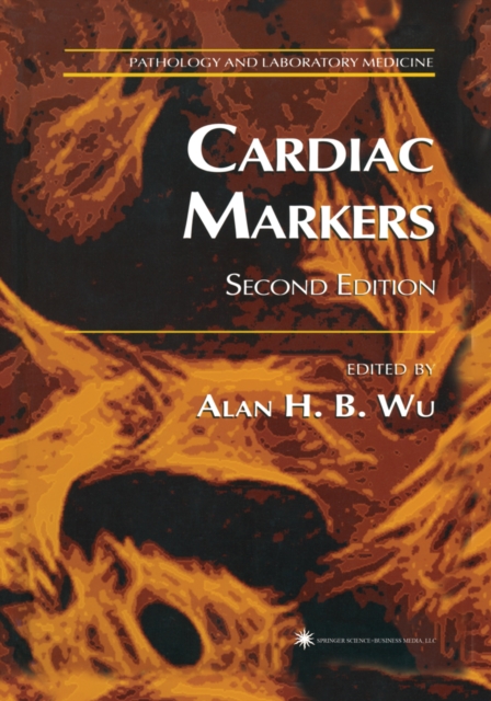 Cardiac Markers, PDF eBook