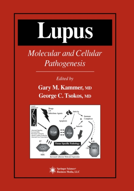Lupus : Molecular and Cellular Pathogenesis, PDF eBook