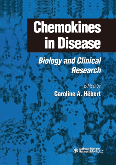 Chemokines in Disease : Biology and Clinical Research, PDF eBook