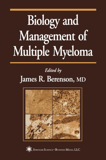 Biology and Management of Multiple Myeloma, PDF eBook