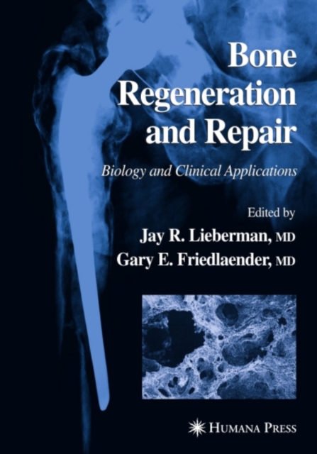 Bone Regeneration and Repair : Biology and Clinical Applications, PDF eBook