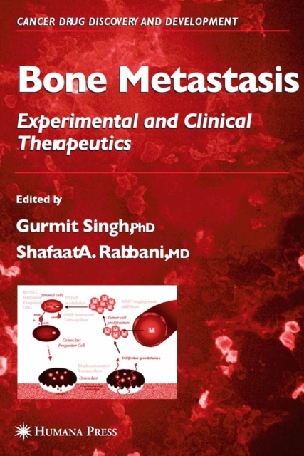 Bone Metastasis, PDF eBook