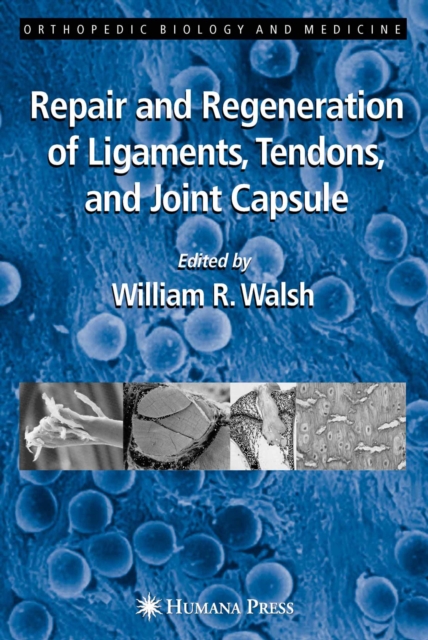 Repair and Regeneration of Ligaments, Tendons, and Joint Capsule, PDF eBook