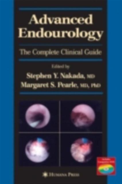 Advanced Endourology : The Complete Clinical Guide, PDF eBook