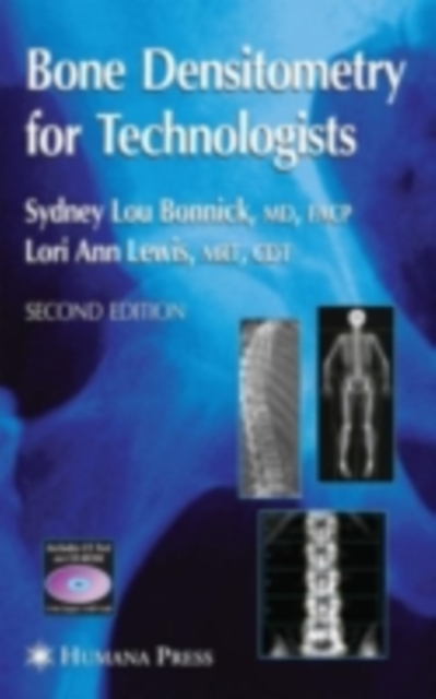 Bone Densitometry for Technologists, PDF eBook