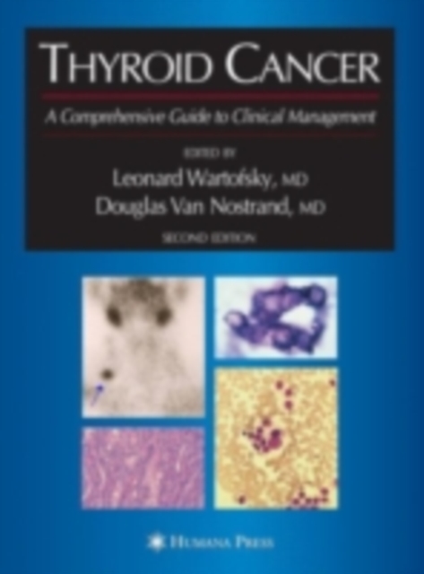 Thyroid Cancer : A Comprehensive Guide to Clinical Management, PDF eBook