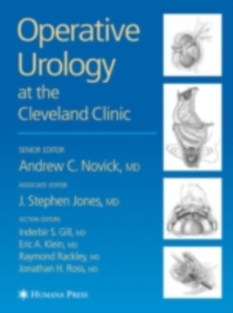 Operative Urology, PDF eBook