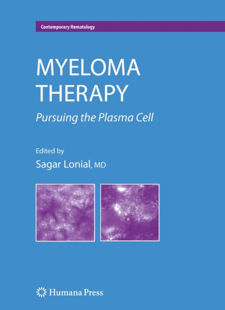 Myeloma Therapy : Pursuing the Plasma Cell, PDF eBook