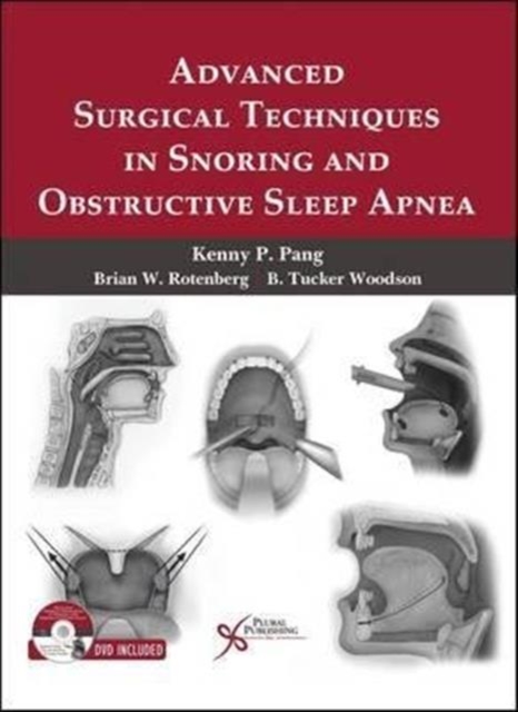 Advanced Surgical Techniques in Snoring and Obstructive Sleep Apnea, Hardback Book