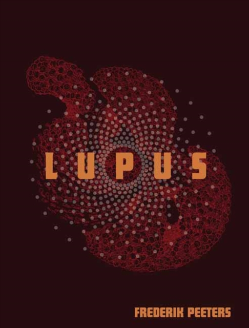 Lupus, Paperback / softback Book