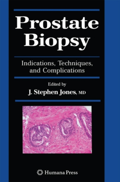 Prostate Biopsy : Indications, Techniques, and Complications, PDF eBook