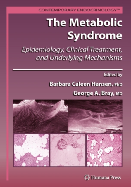 The Metabolic Syndrome: : Epidemiology, Clinical Treatment, and Underlying Mechanisms, PDF eBook