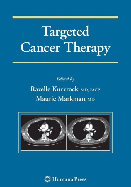 Targeted Cancer Therapy, Hardback Book