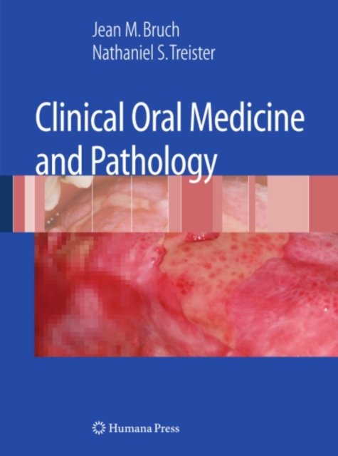 Clinical Oral Medicine and Pathology, PDF eBook