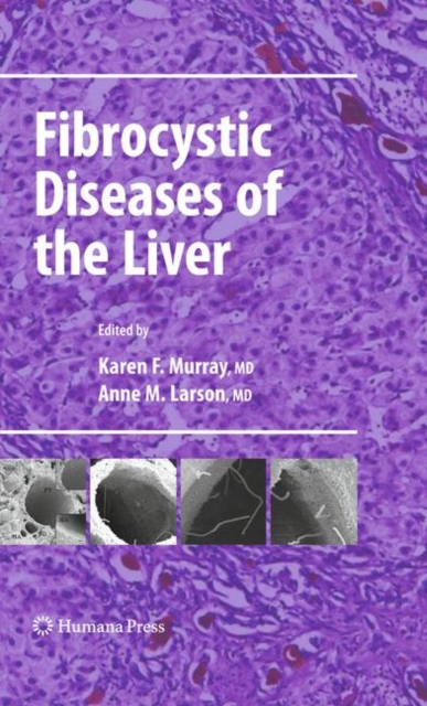 Fibrocystic Diseases of the Liver, Hardback Book
