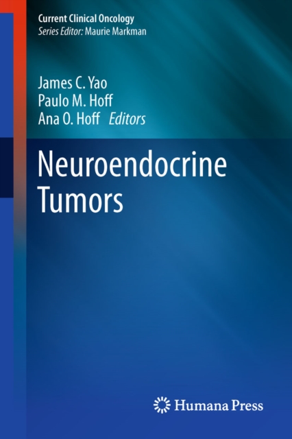 Neuroendocrine Tumors, PDF eBook
