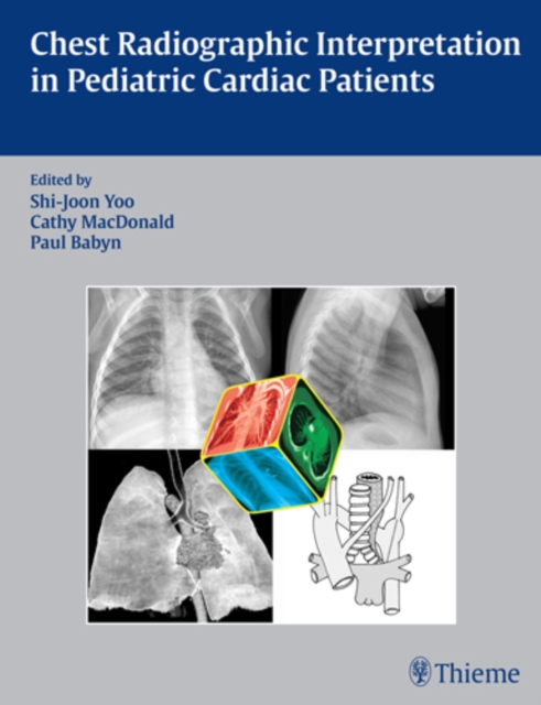 Chest Radiographic Interpretation in Pediatric Cardiac Patients, Hardback Book