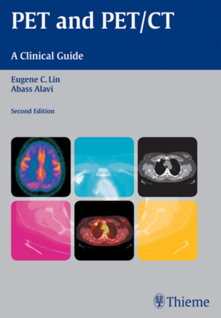 PET and PET/CT : A Clinical Guide, Paperback / softback Book