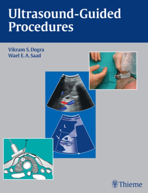 Ultrasound-Guided Procedures, Paperback / softback Book