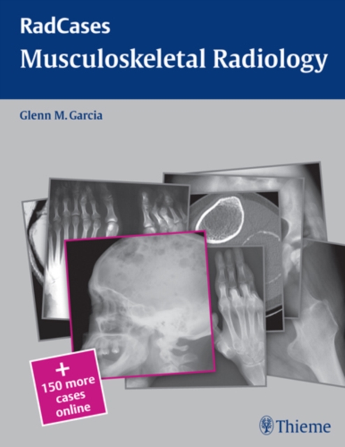 Radcases Musculoskeletal Radiology, Paperback Book