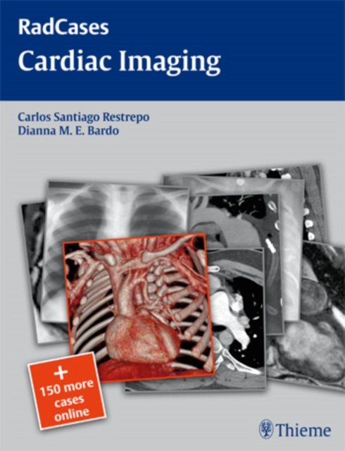 Radcases Cardiac Imaging, Paperback / softback Book