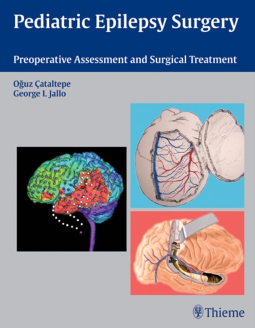Pediatric Epilepsy Surgery : Preoperative Assessment and Surgical Treatment, Hardback Book