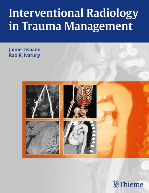 Interventional Radiology in Trauma, Hardback Book
