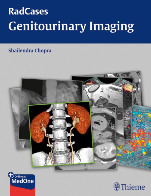 Radcases Genitourinary Imaging, Paperback / softback Book