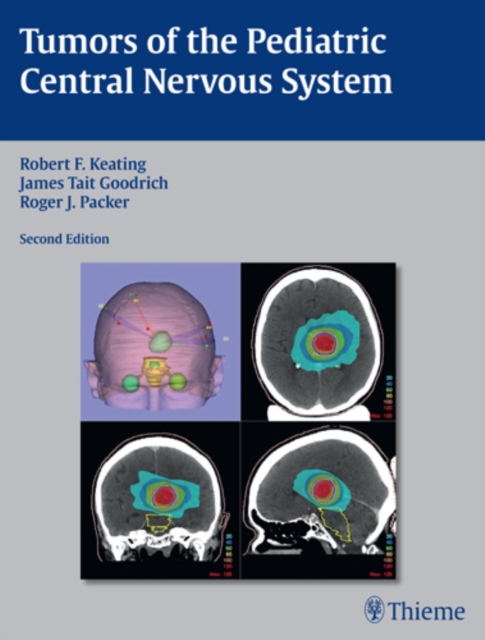 Tumors of the Pediatric Central Nervous System, Hardback Book
