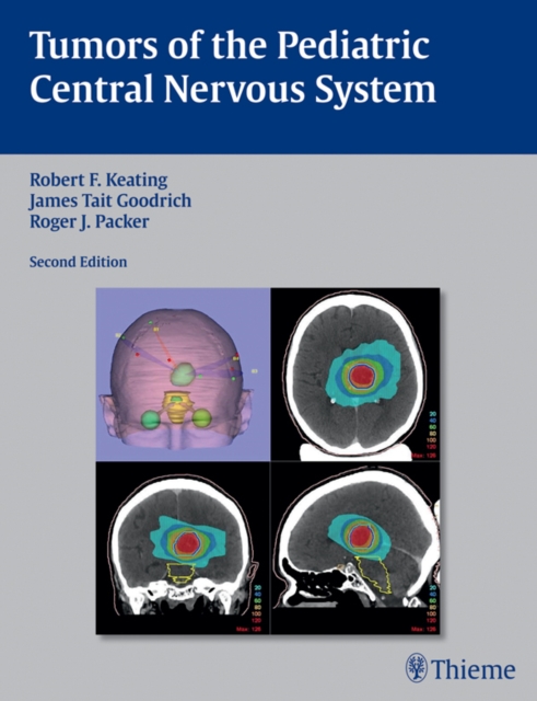 Tumors of the Pediatric Central  Nervous System, EPUB eBook