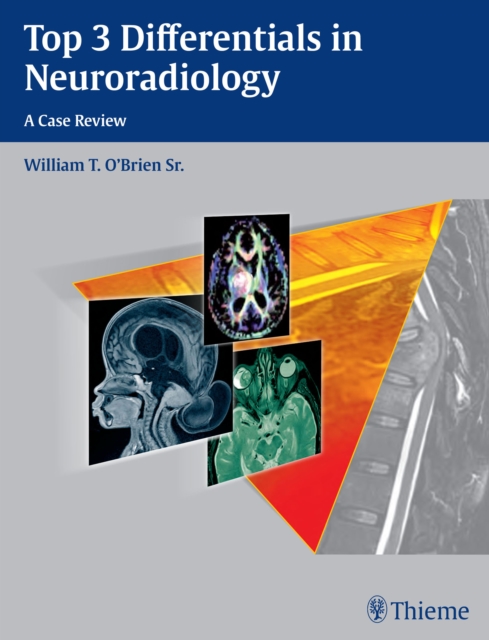 Top 3 Differentials in Neuroradiology : A Case Review, Paperback / softback Book