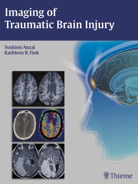 Imaging of Traumatic Brain Injury, Hardback Book