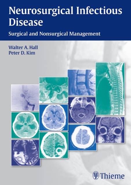 Neurosurgical Infectious Disease : Surgical and Nonsurgical Management, Hardback Book