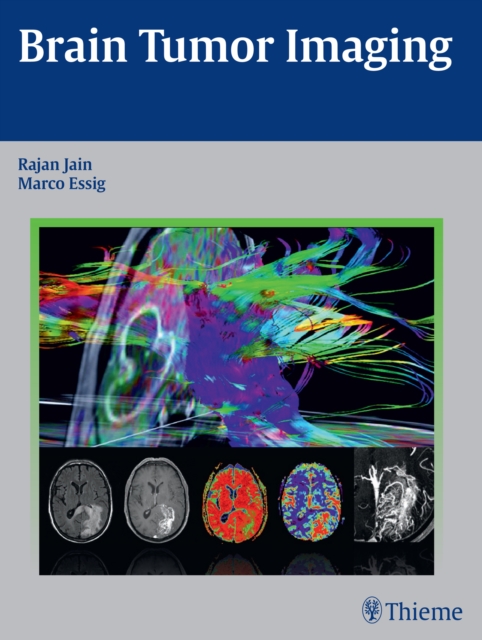 Brain Tumor Imaging, Hardback Book