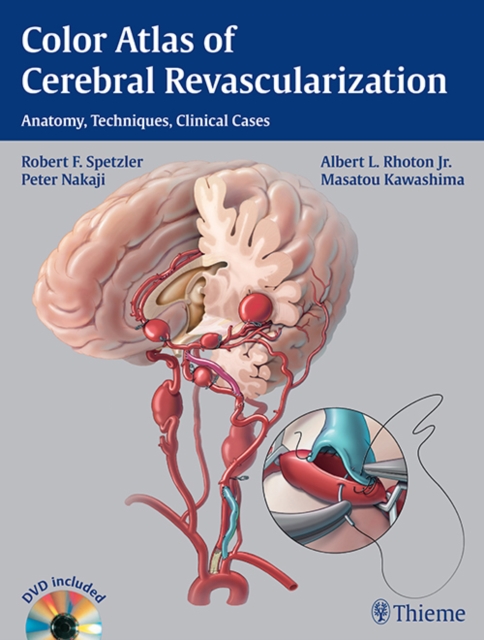 Color Atlas of Cerebral Revascularization : Anatomy, Techniques, Clinical Cases, Hardback Book