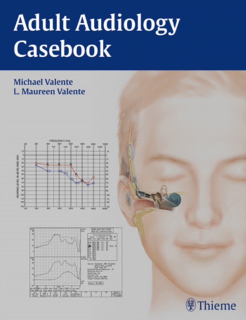 Adult Audiology Casebook, Paperback / softback Book